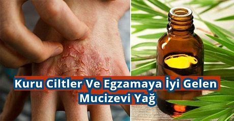 Kuru Ciltler Ve Egzamaya İyi Gelen Mucizevi Yağ