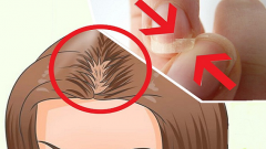 Kırılan Tırnaklar ve Saç Seyrelmesi İçin Harika İksir