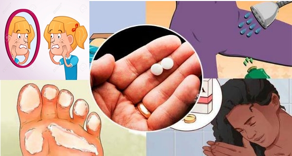 Bir Türlü Çözülemeyen O sorunların Çaresi Aspirinmiş İşte Aspirin Mucizeleri