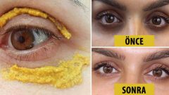 Göz Altı Torbaları İçin Zerdeçal Maskesi Deneyin