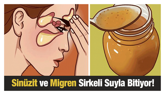 Sinüzit ve Migren Ağrılarına Bu Şekilde Son Verebilirsiniz