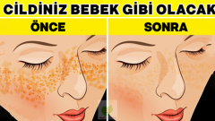 Kusursuz Bebek Gibi Bir Cilt İçin..!