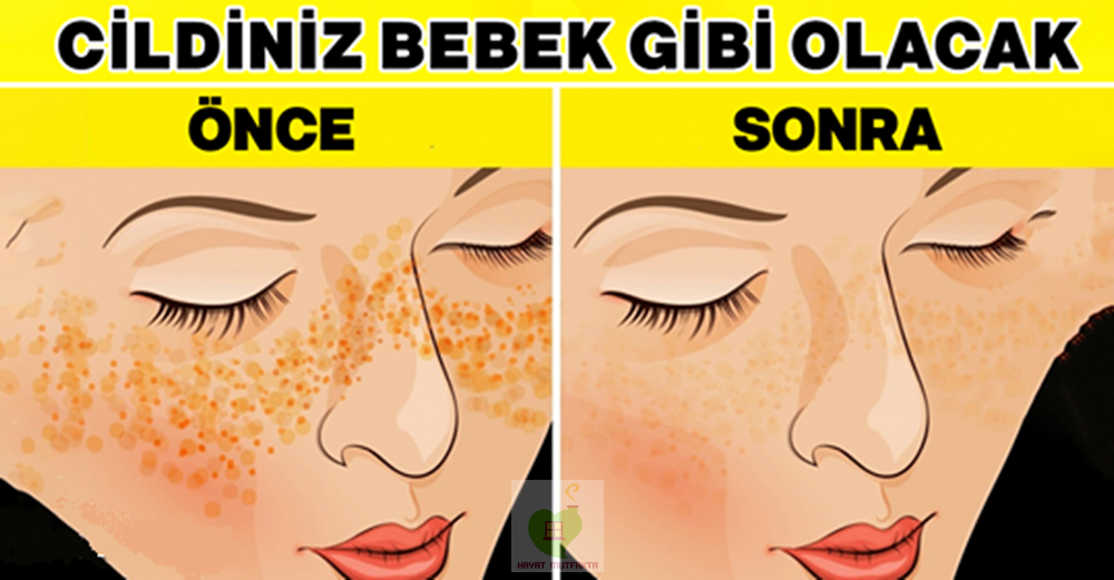 Kusursuz Bebek Gibi Bir Cilt İçin..!