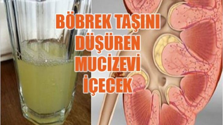 Böbrek Taşını Düşüren Doğal İçecek