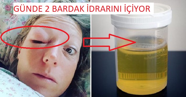 Her Gün 2 Bardak İdrarını İçiyor!Nedenini Okuyunca Çok Şaşıracaksınız!