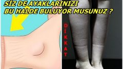 Kalp Sorunları Gelmeden Önce Size İşaretler Veriyor Dikkat Edin