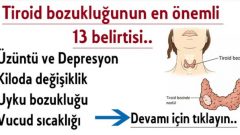 Tiroid bozukluğunun en önemli 13 belirtisi..