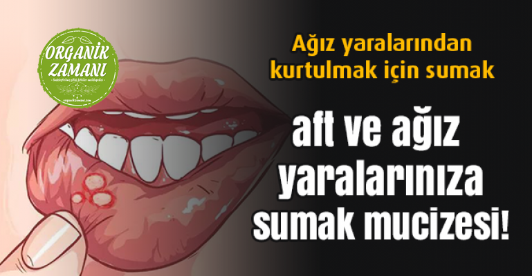 Aft Ve Ağız Yarasına ‘Sumak’ Mucizesi!