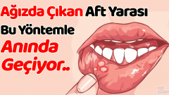 Aft Yarası Neden Çıkar, Kaç Günde Nasıl Geçer?