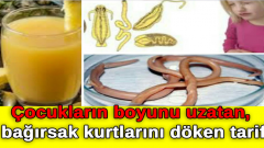 Çocukların boyunu uzatan, bağırsak kurtlarını döken tarif