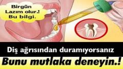 Diş Ağrısından Duramıyorsanız
