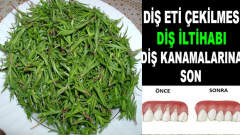 Diş eti çekilmesi Diş iltihabı son.