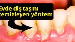 Evde Diş Taşını Temizleyen Yöntem