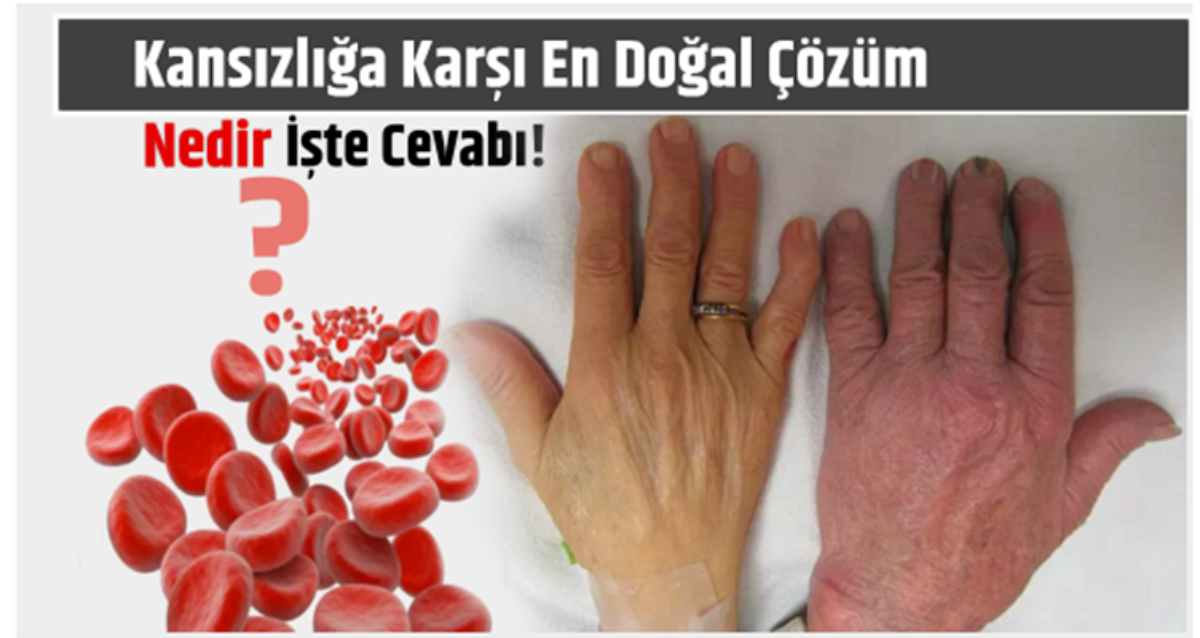 Kansızlığa karşı en doğal çözüm!