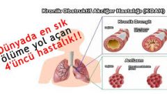 İçilen Her Sigaranın Seni Bu Hastalığa Yaklaştırdığını Biliyor Musun..?