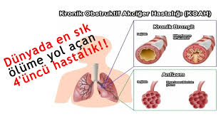 İçilen Her Sigaranın Seni Bu Hastalığa Yaklaştırdığını Biliyor Musun..?