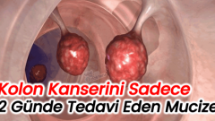 Kolon Kanserini Sadece 2 Günde Tedavi Eden Besin
