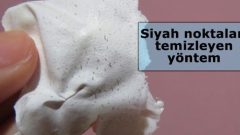 Siyan Noktaları Temizleyen Doğal Yöntem