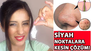 Siyah Noktalardan Kurtulmak İçin Kesin Çözüm