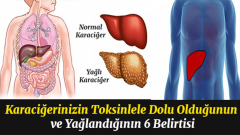 Karaciğerinizin Toksinlerle Dolu Olduğunu Gösteren 6 Belirti