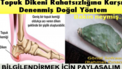 Topuk dikenine karşı denenmiş doğal yöntemler..
