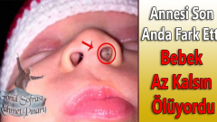 Annesi Son Anda Fark Etti Bebek Az Kalsın Ölüyordu