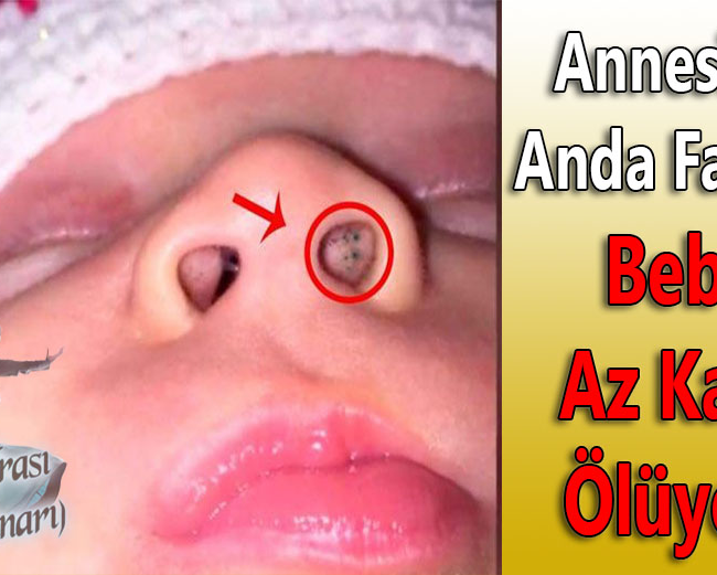 Annesi Son Anda Fark Etti Bebek Az Kalsın Ölüyordu